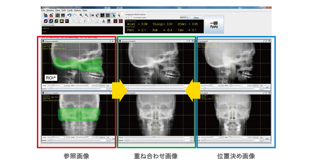 PIAS位置決め画像