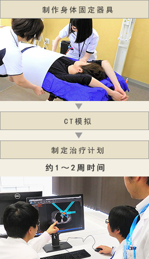 制作身体固定器具 → CT模拟 → 制定治疗计划　约1～2周时间