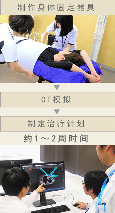 制作身体固定器具 → CT模拟 → 制定治疗计划　约1～2周时间