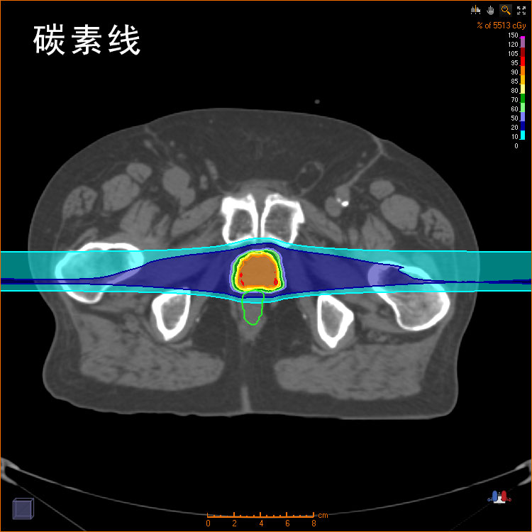 炭素線