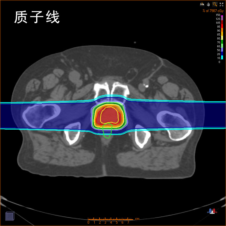 陽子線