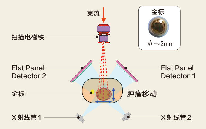 动体追踪照射系统的构成