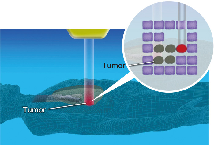 Heavy ion beam irradiation image