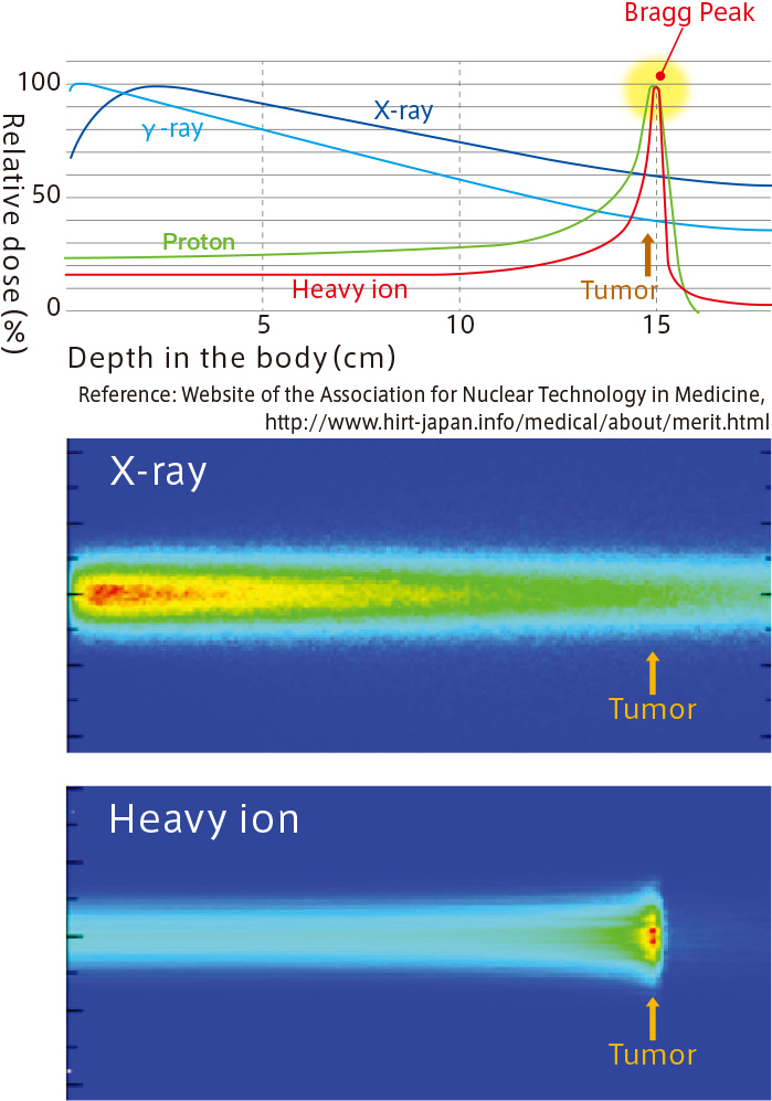 Dose distribution in vivo of various kinds of radiation