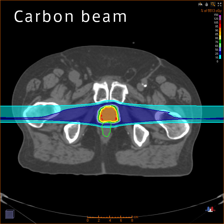 Carbon beam