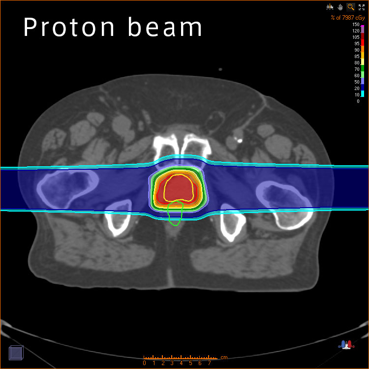 Proton beam