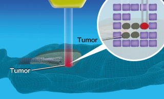 Advantages of heavy ion therapy