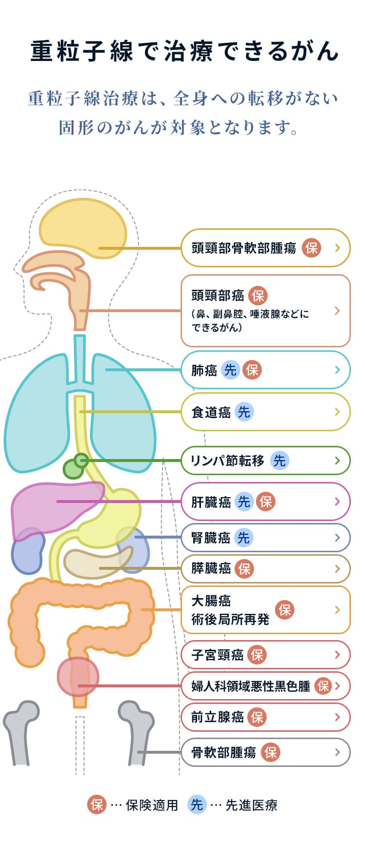 重粒子線で治療できるがん 重粒子線治療は、全身への転移がない固形のがんが対象となります。