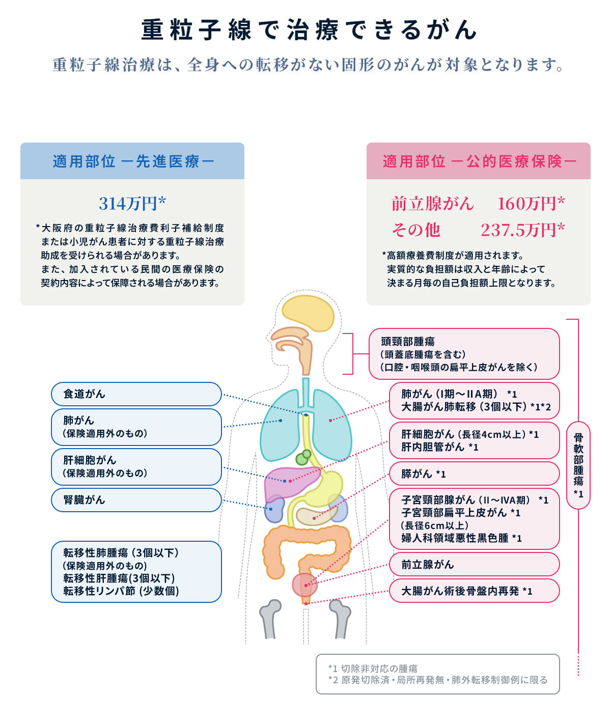重粒子線で治療できるがん 重粒子線治療は、全身への転移がない固形のがんが対象となります。