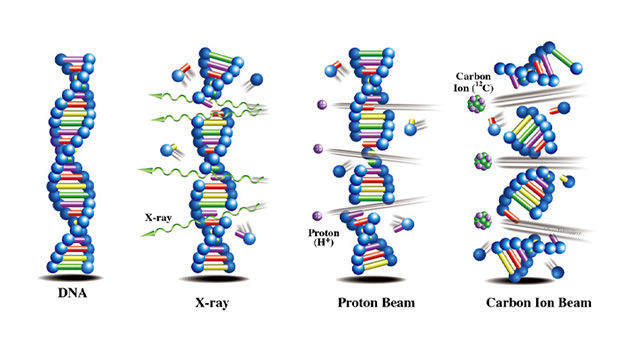 重粒子線治療の特長