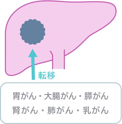 肝臓イメージ